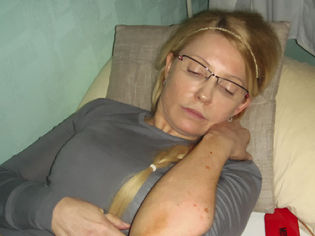 Файл:315px-Тимошенко - синяки 2.jpg