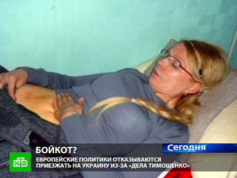 Файл:Тимошенко - синяки 3.jpg